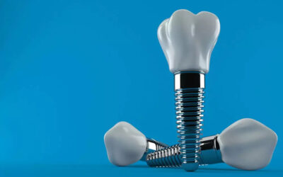 Are Dental Implants Safe?