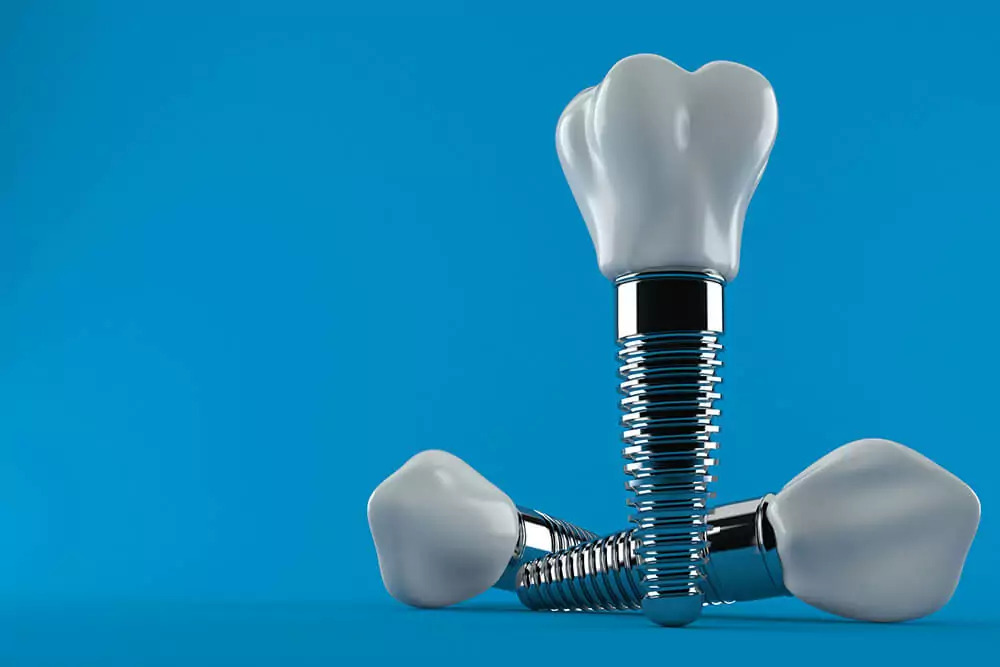 Are Dental Implants Safe?