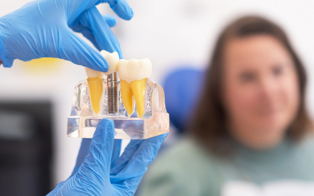 Is It Possible to Get Full‑Mouth Implants if I Have Osteoporosis? Tips from Dr. Collins