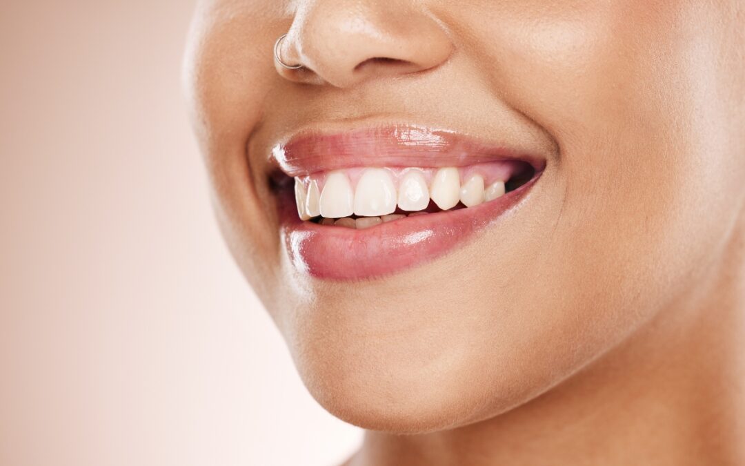 Cosmetic Dentistry for Gummy Smiles: Procedures & Benefits