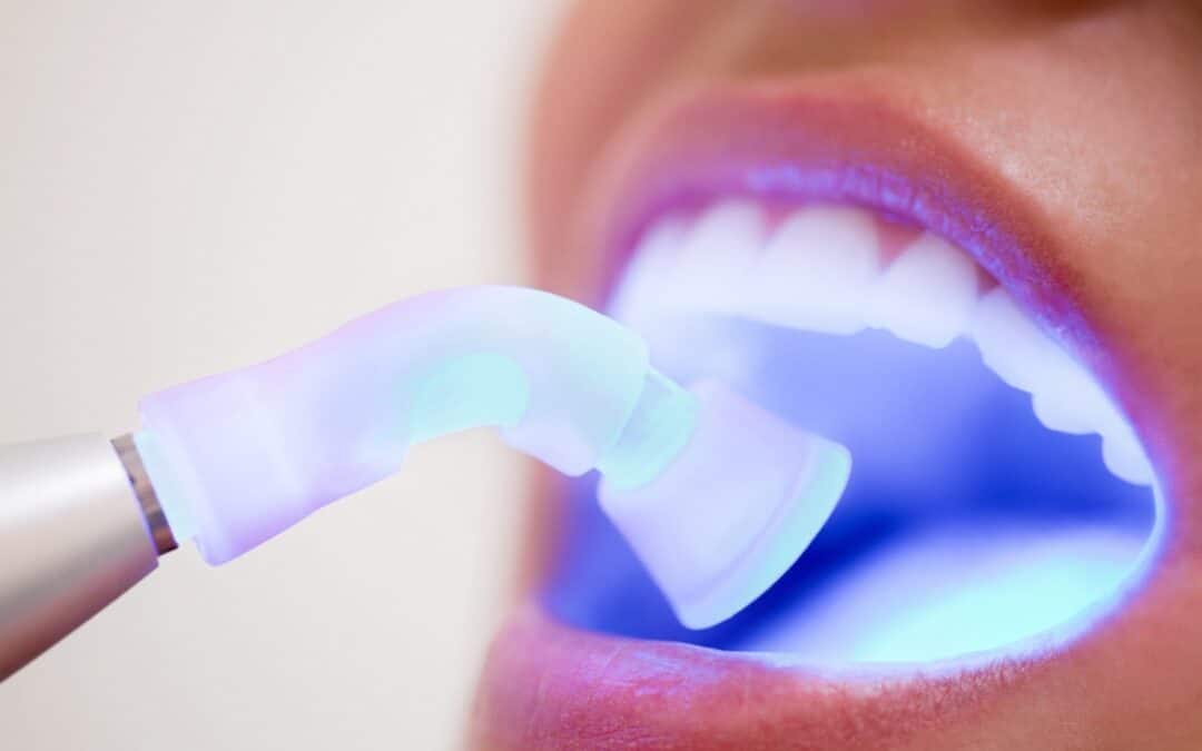 Gentle Dental Care: How Laser Dentistry Reduces Dental Anxiety