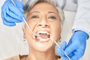 dental-bridges-in-Manvel