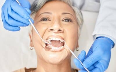 Maintaining Your Dental Bridge: Tips from Dr. Collins