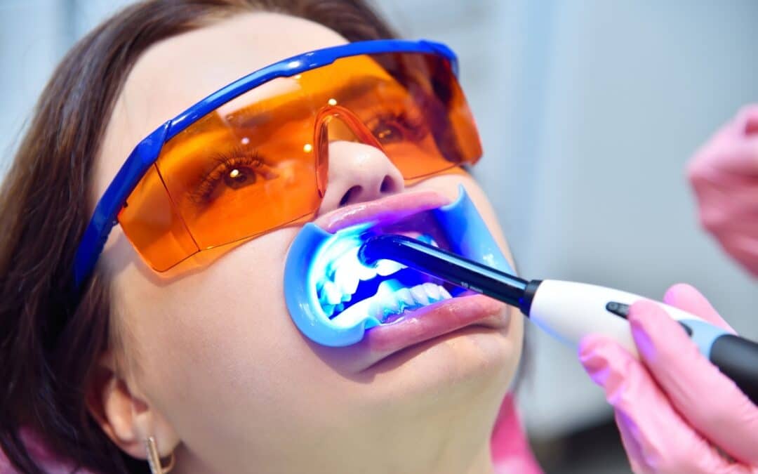 How Professional Teeth Whitening in Manvel Can Reverse Coffee Stains